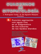 /libros/gonzalez-campora-ricardo-puncion-aspiracion-con-aguja-fina-en-el-diagnostico-de-los-tumores-de-los-tejidos-blandos-cuadernos-de-citopatologia-no-8-L03009850101.html