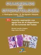 /libros/gonzalez-campora-ricardo-puncion-aspiracion-con-aguja-fina-en-el-diagnostico-de-los-tumores-de-hueso-cuadernos-de-citopatologia-no-11-L27004220101.html